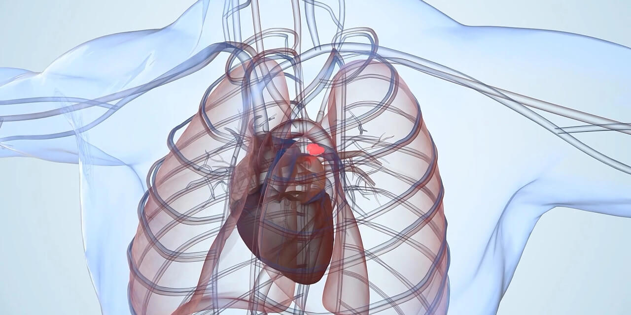 Prozess Erklaerung + medizinische animation